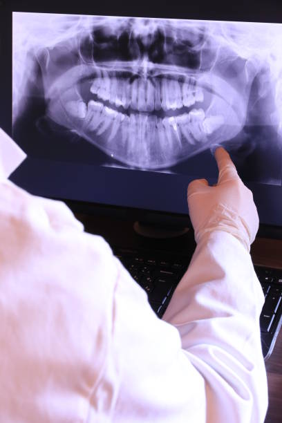 Urgent Tooth Repair in CO